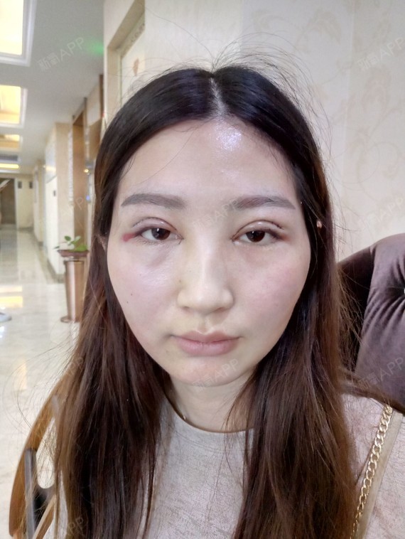 福州眼部综合好不好