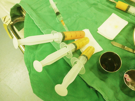 脂肪的填充面部_填充面部脂肪多少钱_填充面部脂肪多久能化妆了