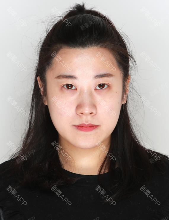 杭州玻尿酸隆鼻好不好_效果图_秋白芍玻尿酸隆鼻术后第0天_新氧美容
