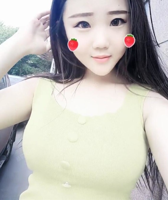 蓝毛怪自体脂肪隆胸术后第93天美丽日记_新氧整形