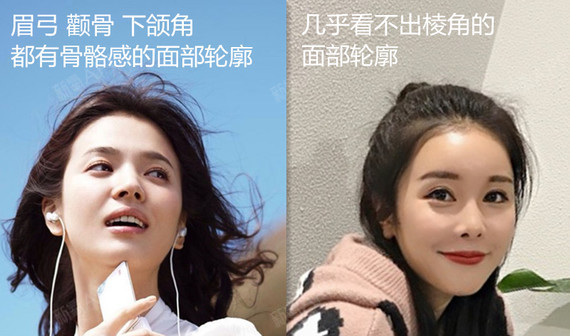 名医直通车|上面部骨相看眉弓,膨体垫眉弓_圈子-新氧美容整形