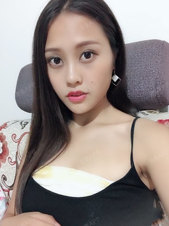 时间过的真快,10天的日记忘记更新,身体疼痛减轻了_圈子-新氧美容整形