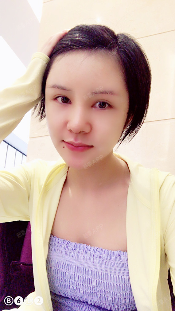 hahha鼻综合第7天美丽日记-新氧美容整形