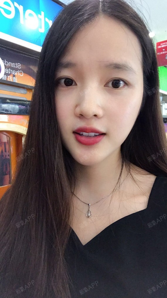 要不是提醒,我也忘记在这里分享做烤瓷牙的经历了.