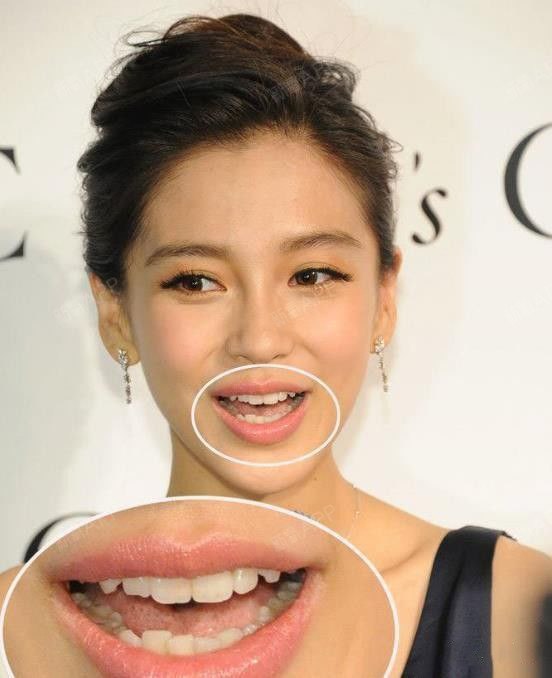 牙齿对颜值的影响,看baby,你就知道了!
