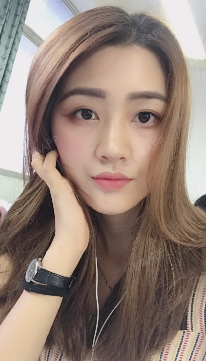 武汉自体脂肪全脸填充好不好_效果图_小小小谢自体脂肪全脸填充术后第