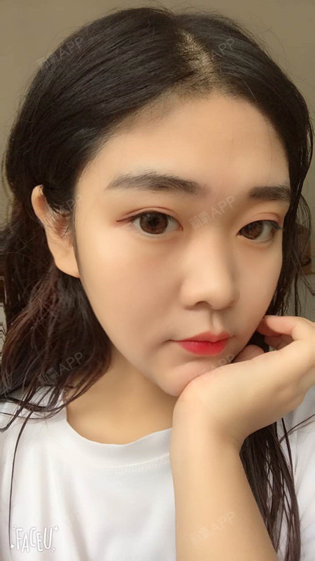 脸瘦下来之后,感觉我的鼻子显得更塌了.