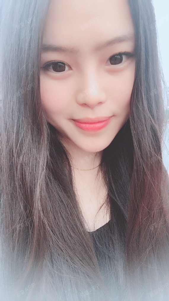 鼻部多项好不好_效果图_小小小圆圆呀鼻部多项术后第62天_新氧美容