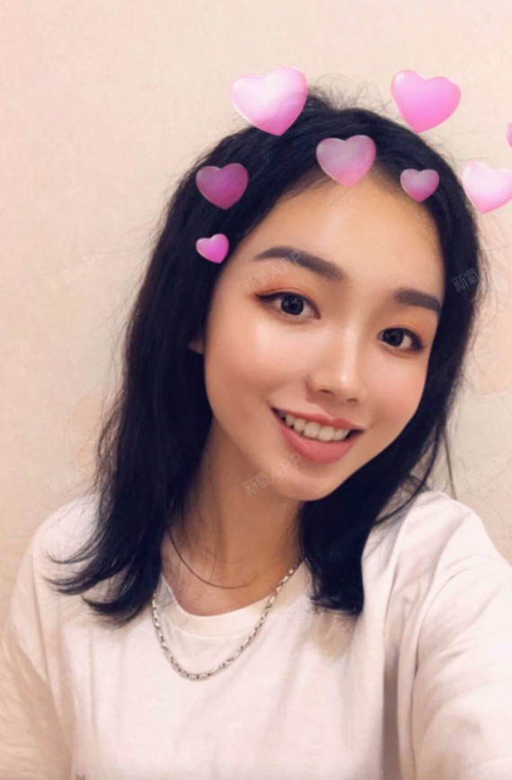 新氧- 想的美是件好事 | 玻尿酸去黑眼圈 | 术后当自强 | 上海同城