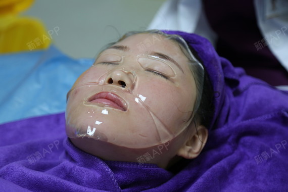 广州黄金微针好不好_效果图_baby1373461506928249黄金微针术后第0天