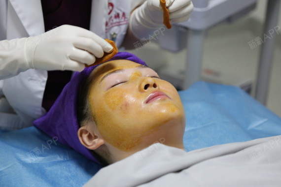 广州黄金微针好不好_效果图_baby1373461506928249黄金微针术后第0天