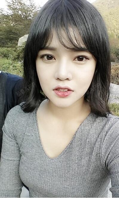 耳软骨复合隆鼻好不好_效果图_karen_lee耳软骨复合隆鼻术后第223天