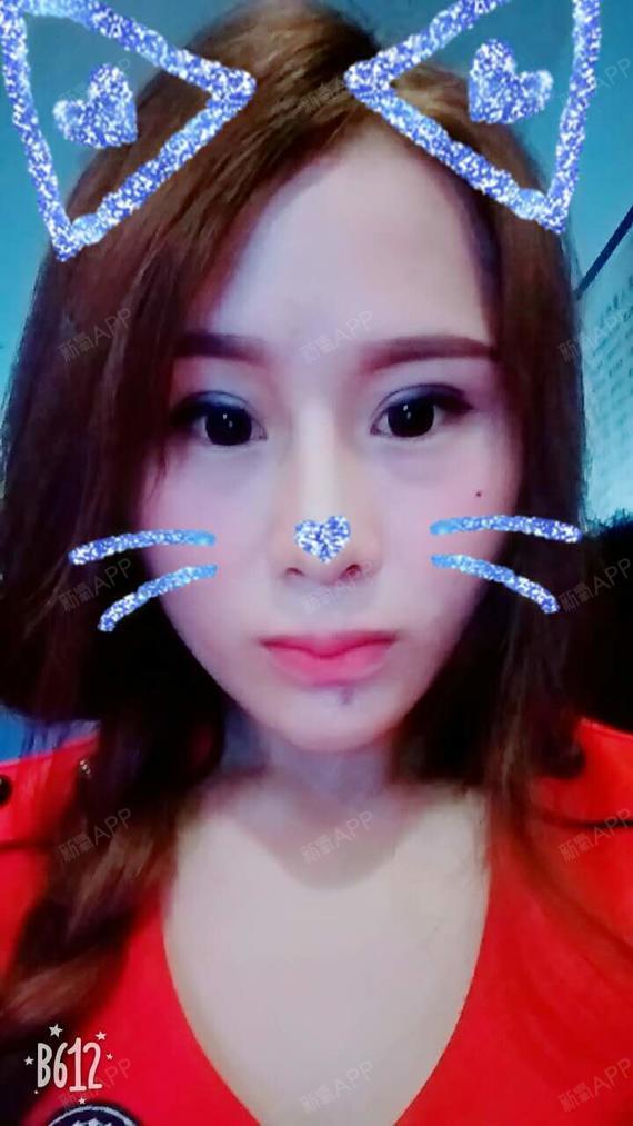 阳光小镇与少女假体隆胸术后第21天美丽日记_新氧整形