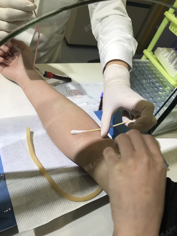 抽血真的是一点都不痛,护士姐姐非常老练