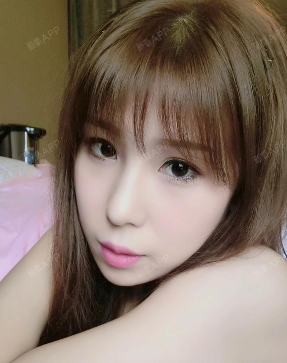 新氧- 妮妮小可爱 | 术后当自强 | 南宁同城 | 鼻部综合
