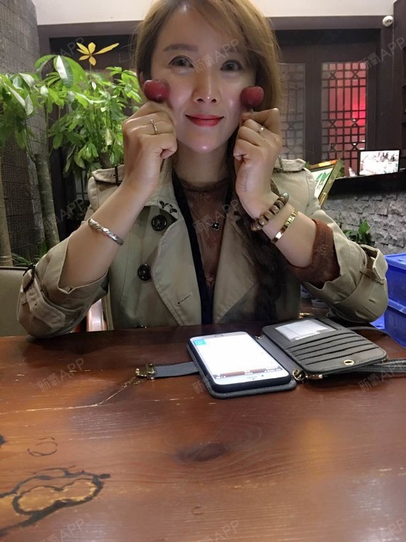 新氧- 万能少女小熙真 | 自体脂肪填充额头 | 自体脂肪填充太阳穴