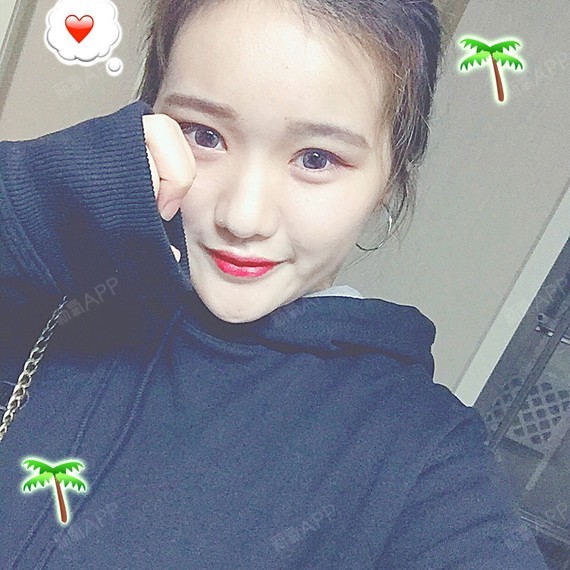 一碗叉烧面部吸脂第15天美丽日记-新氧美容整