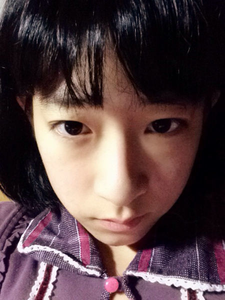 哇塞,案例真棒,我的鼻子太长了,不知道能不能做成这样的,请医生帮