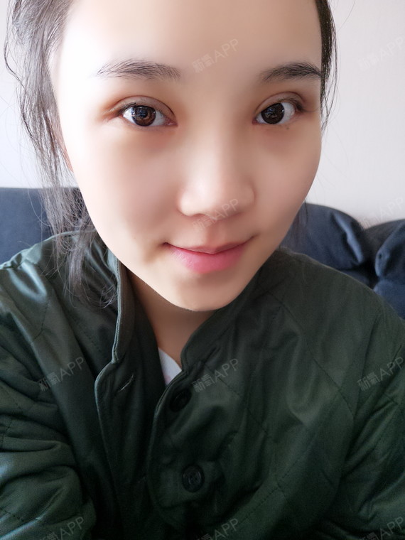 哈喽,新氧宝宝们,双眼皮20天了,眼部漂亮,人也变_圈子-新氧美容整形