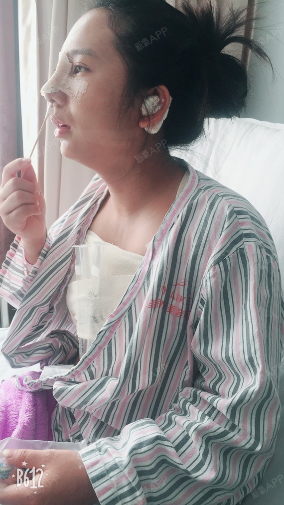 长沙假体隆胸好不好_效果图_北潮默萧假体隆胸术后第3天_新氧美容整形