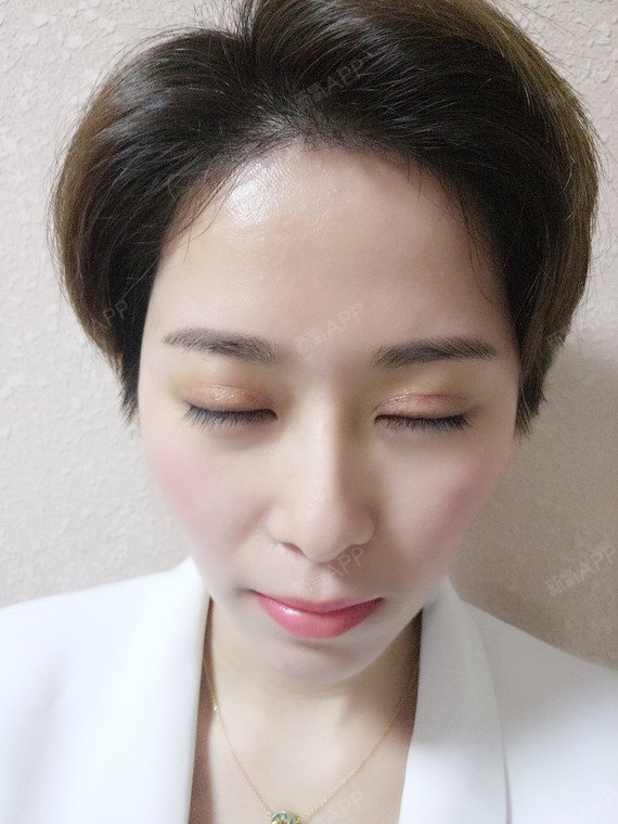 就像他们说的一样,睁眼有神,闭眼无痕~形状弧度还有恢复的