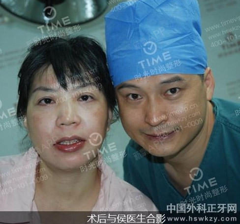 牙龈外露严重,一直不敢大笑,直到在广州时光进行侯振杰外科正牙后