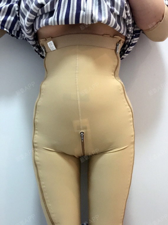 吸脂瘦腹部好不好_效果图_曾经留不住的美丽吸脂瘦腹部术后第3天_新氧