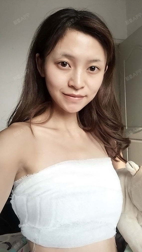 假体隆胸