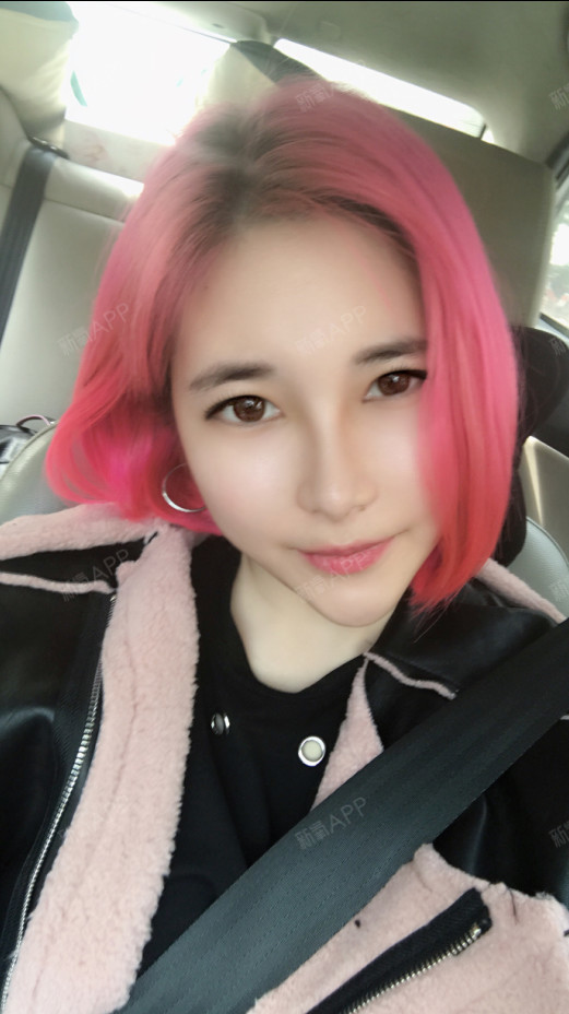 新氧- 路边的野花最勾人 | 鼻部 | 隆鼻 | 术后当自强 | 秦皇岛同城