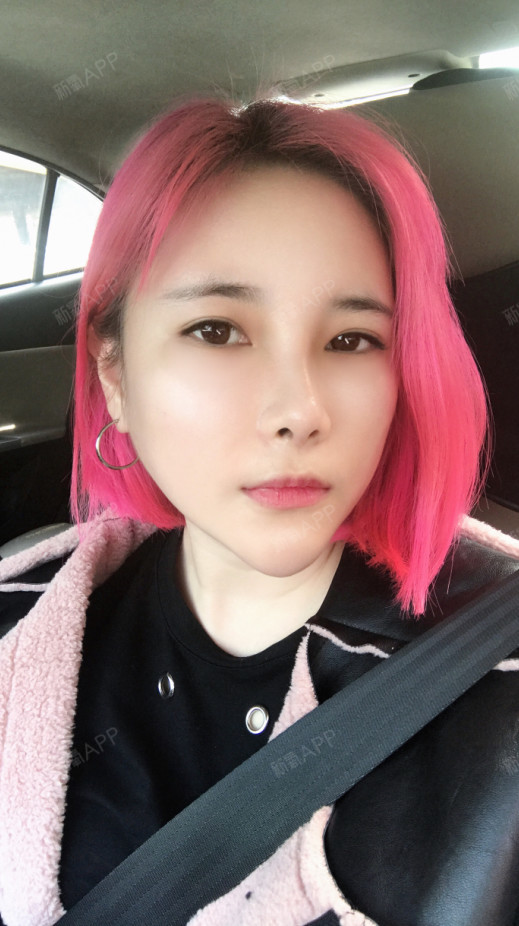 新氧- 路边的野花最勾人 | 鼻部 | 隆鼻 | 术后当自强 | 秦皇岛同城