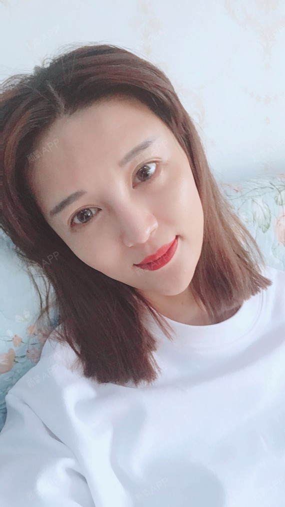 【济南星范医美】【babyface脂肪填充】哇哦时_圈子-新氧美容整形