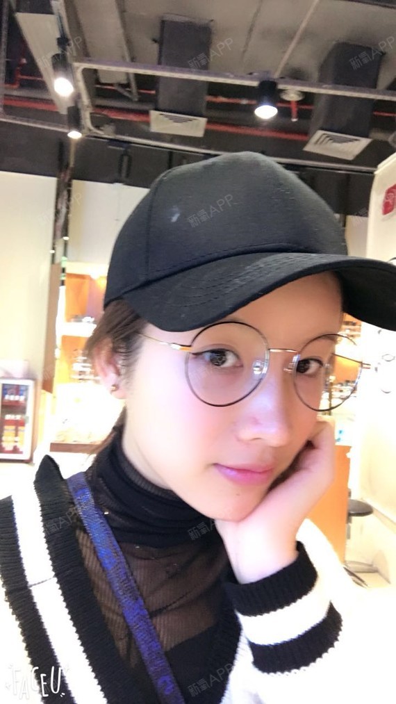 瘦腿跨入第二个月了![:42]其实我是在注射后三天_圈子-新氧美容整形