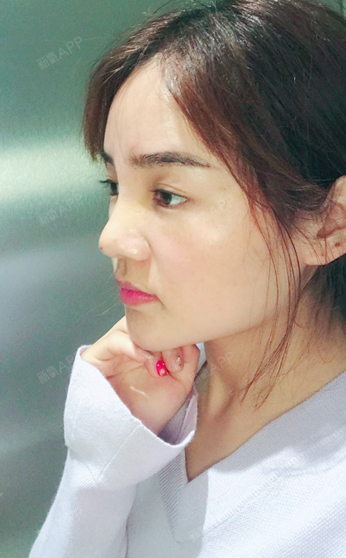 侧面看上去鼻子线雕效果很明显.