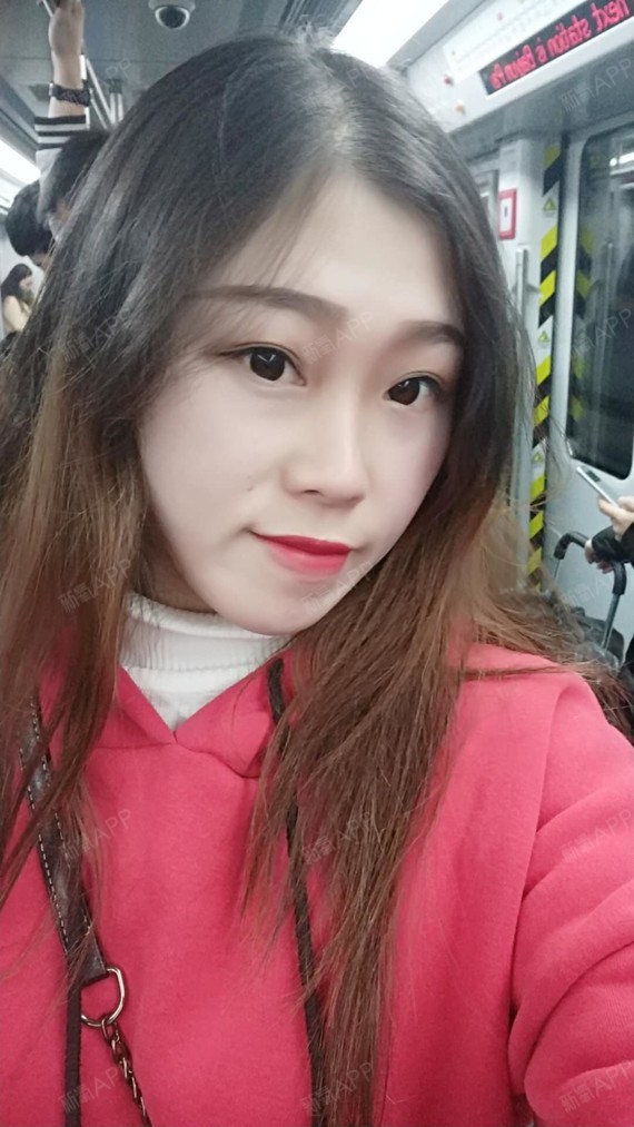 现在已经是术后的二十天咯,最近真的很忙,一直在忙着_圈子-新氧美容