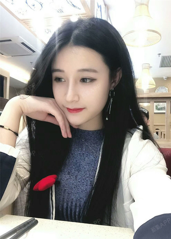 说一下基本情况吧,鼻小柱疤痕已经完全看不出了,担