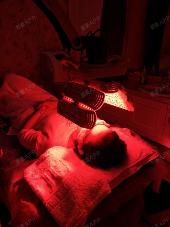 北京红蓝光祛痘好不好_效果图_杨三三三红蓝光祛痘术后第0天_新氧美容