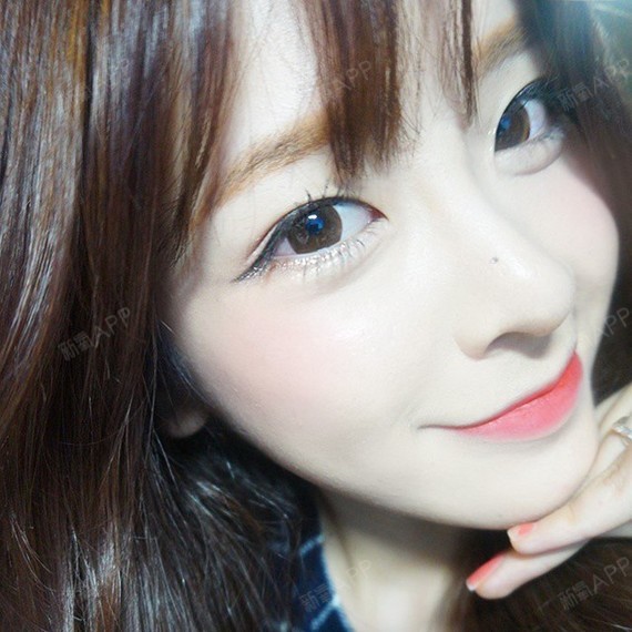 【江苏施尔美玻尿酸丰唇术后16天】都说嘴唇薄的女生_圈子-新氧美容