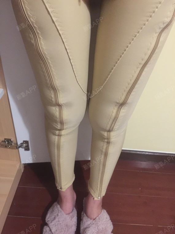 大腿环绕吸脂半个月,很明显大腿内侧的赘肉没有了,因_圈子-新氧美容