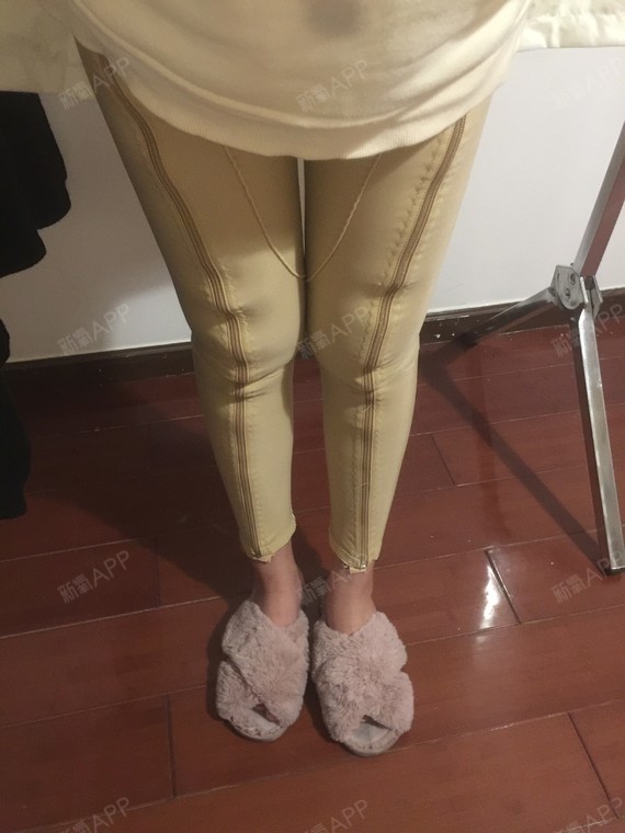 大腿环绕吸脂半个月,很明显大腿内侧的赘肉没有了,因_圈子-新氧美容