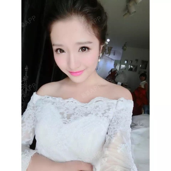 术后五个月了,现在脸部看上去玲珑可爱哈哈~觉得这样_圈子-新氧美容