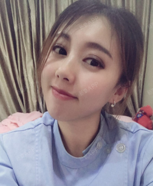 【沈阳丽都切开双眼皮 开内眼角案例分享】