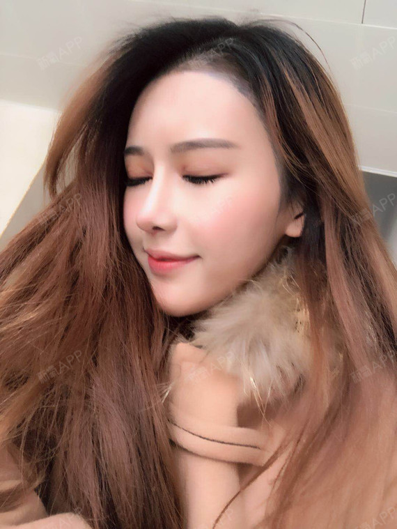 广州鼻部多项好不好_效果图_秋风の鼻部多项术后第75天_新氧美容整形