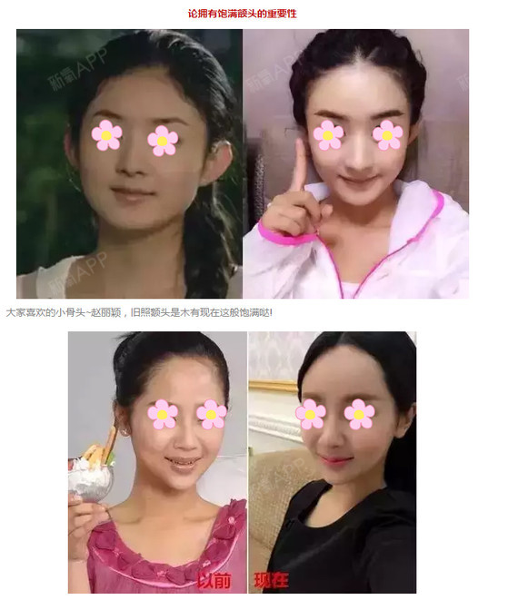 额头饱满的姑娘,颜值和运气都不会太差!