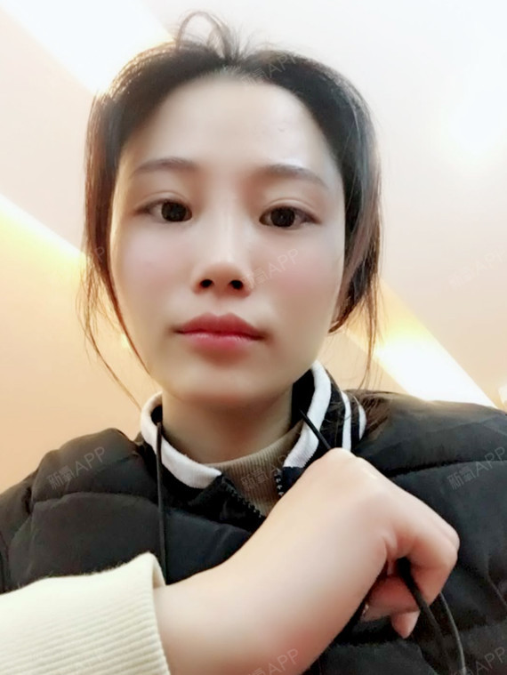 想要做双眼皮的妹子,也不要太过于犹豫了,做了双眼皮会让 你的