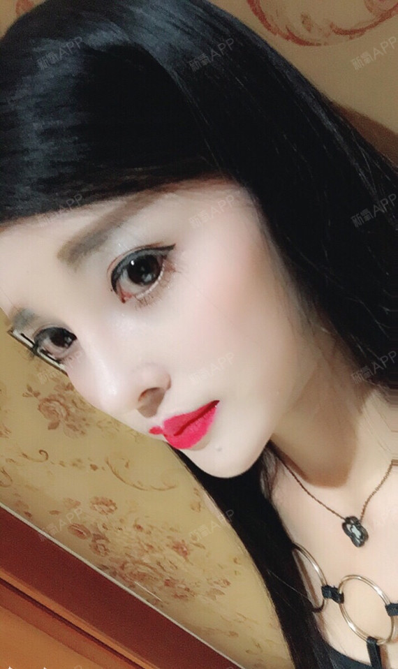 上海膨体隆鼻好不好_效果图_纪幻巧i膨体隆鼻术后第22天_新氧美容整形