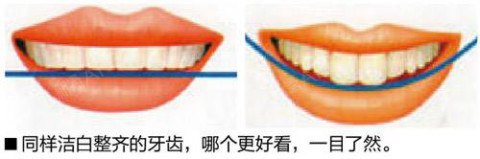 笑线可能会让你走上人生巅峰什么是笑线？笑线当然与迷_圈子-新氧美容整形