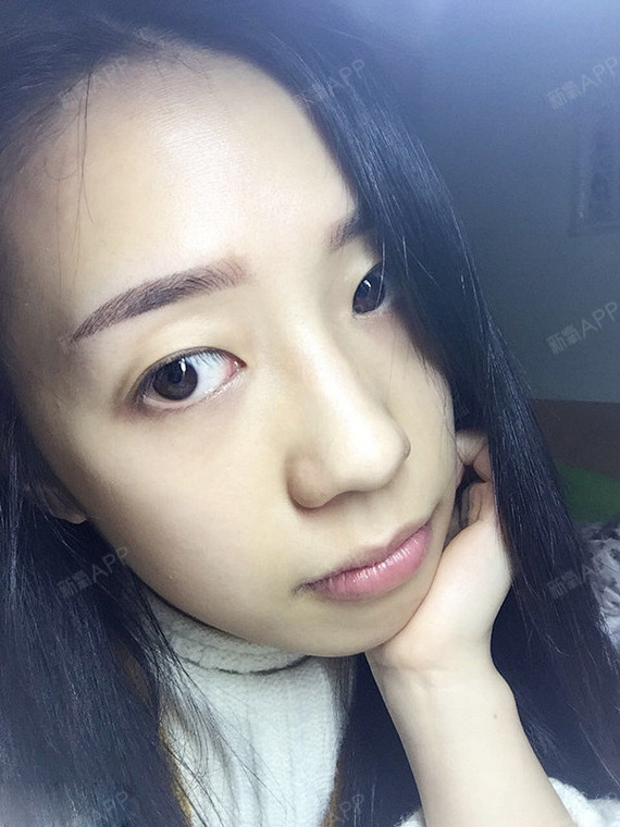 纹眉的第二天,眉毛已经不红了但是颜色比较深,但是绝_圈子-新氧美容