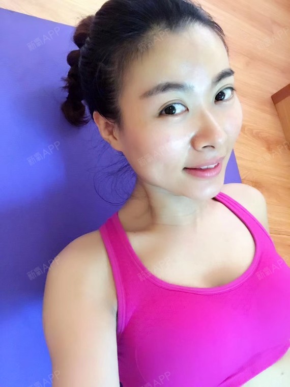 新氧- 娜娜妮 | 胸部 | 隆胸 | 假体隆胸 | 术后当自强 | 广州同城