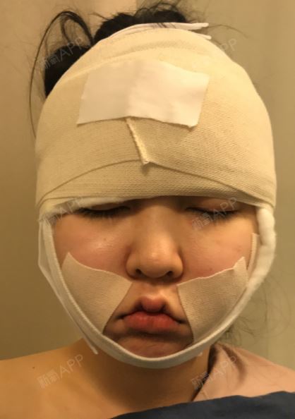 纱布也包得倒是很实在