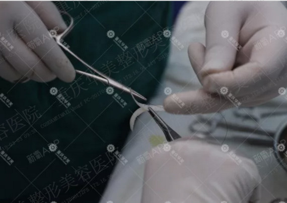 上一秒隆鼻,下一秒医生就动手做猪鼻子了!